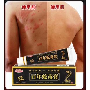 妙如莲百年蛇毒膏 正品 可搭抑菌膏