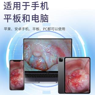 妇科私密检测仪高清可视摄像人体阴道宫颈手机无线 线多功能内视