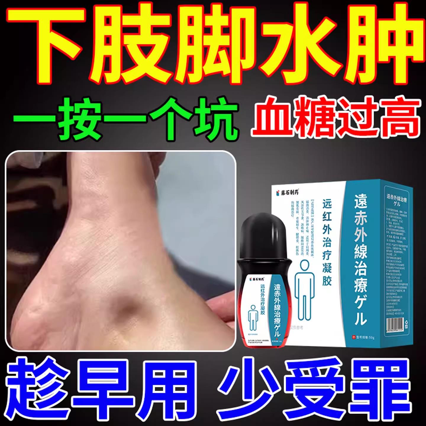 老血糖高脚肿去水肿专用小腿浮肿下肢排水肿痛消喷剂C人A医星熊旗