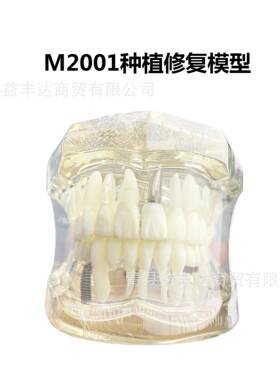 M2001病理模型牙齿模型备牙嵌体龋齿模型种植模型牙齿可拆卸