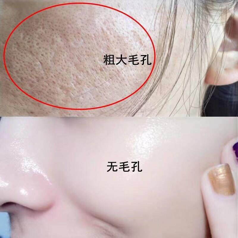 【氏推荐】别挤让我吸 排出脏东西 去面部毛孔垃圾 男女通用~