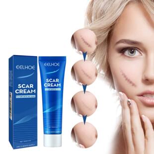 EELHOE Skin Care Cream - Gentle External Body Care for Moist