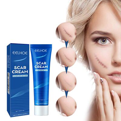 EELHOE Skin Care Cream - Gentle External Body Care for Moist