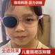 单眼眼罩真丝遮光透气弱视斜视成人儿童小孩单眼罩独眼遮盖遮眼布