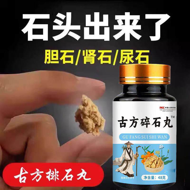 【溶石排石】鸡内金碎石丸化石溶石洁石去输尿管胆囊膀胱结肾石