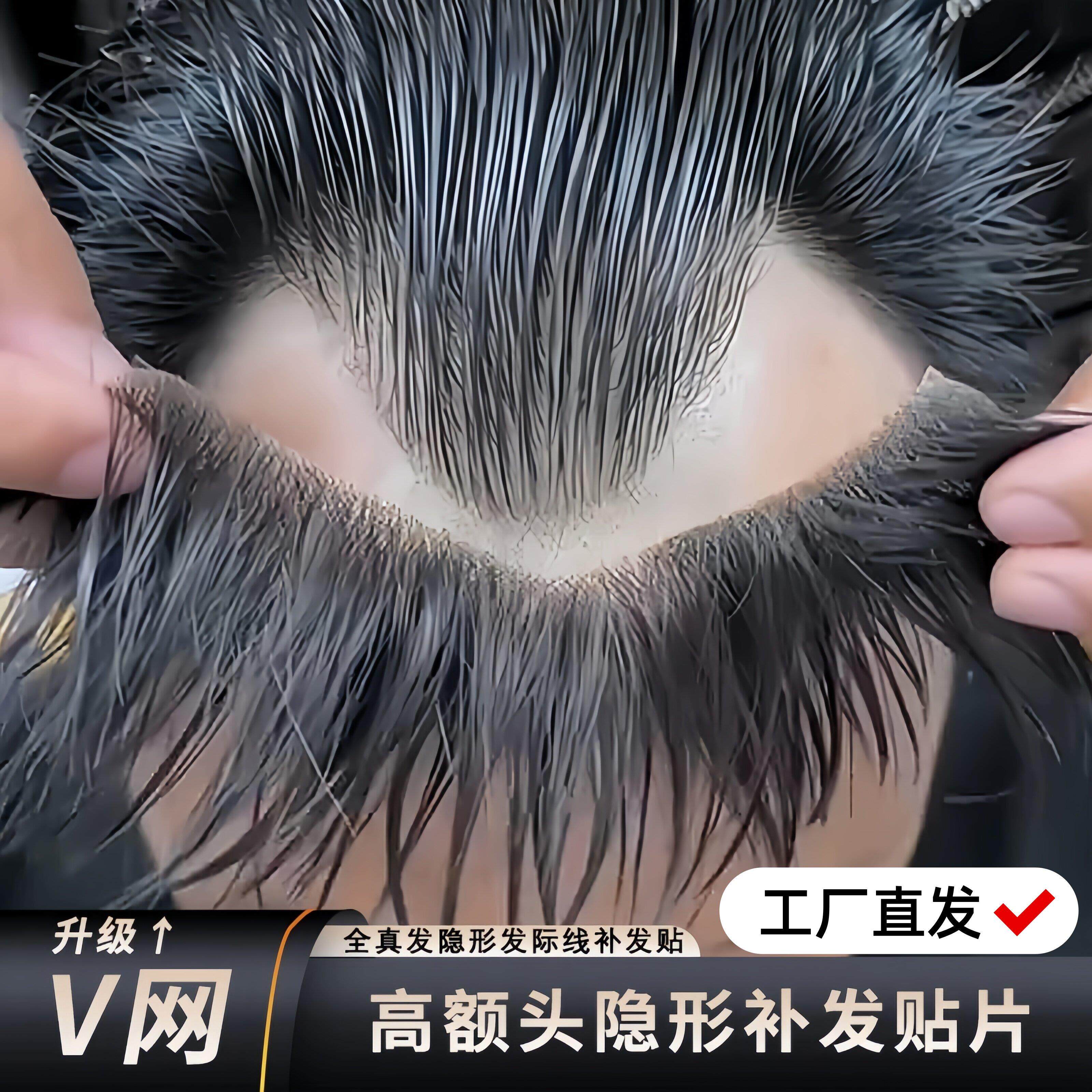 深v形发际线假发贴假刘海假发片m形发际线贴男一片式前额补发真发