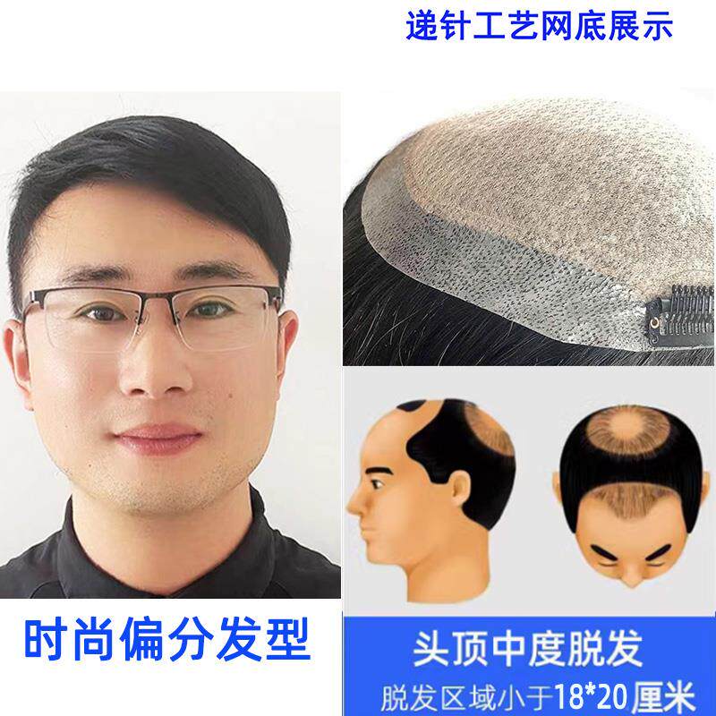 正品假发男短发男士头顶真发浏海织发补发片块脱发前额手织自然补