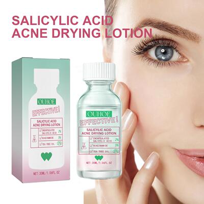 OUHOE Salicylic Acid Acne Lotion Gentle Care for Acne-Prone