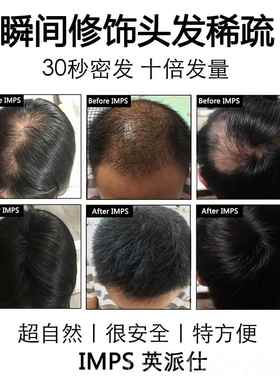正品美IMPS发际线填充浓密纤增多发补发神器密发增头发假发粉发少