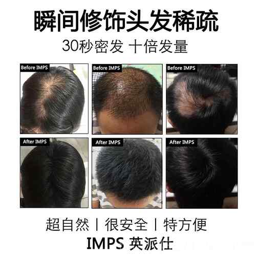 正品美IMPS发际线填充浓密纤增多发补发神器密发增头发假发粉发少
