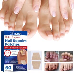 Ximonth Nail Repair Strips - Gentle Cleaning, Nutritive Care