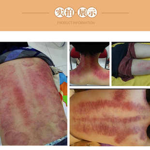 厂家直销擀筋棒刮痧棒擀筋棍仗推筋疗法养生棒背部经棒