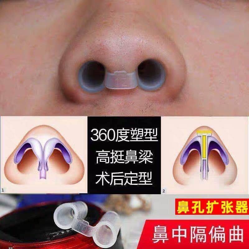 鼻撑隆鼻术后定型鼻子支撑鼻孔扩张器鼻中隔偏曲矫正通气鼻夹止鼾
