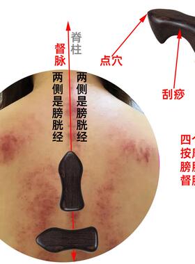 高档经摩络摩狗推拿按工具背部经络疏通按按摩器动力虎脊柱摩按器
