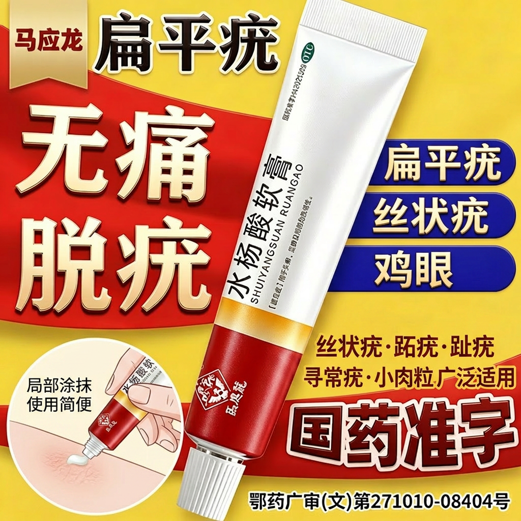 水杨酸软膏正品丝状疣趾疣祛疣去疣专用跖疣鸡眼药膏医用非特效NN