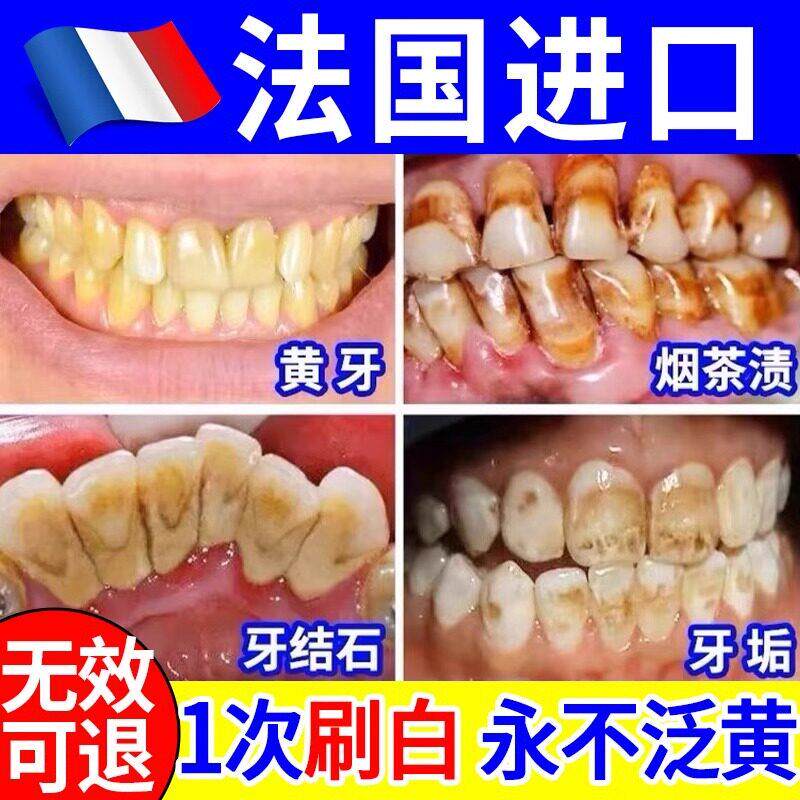 牙粉牙齿污垢清洁溶解牙石洗白去口臭正品官方品牌店