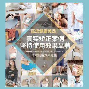 德国脚趾矫正器拇外翻拇指分趾器女士大母足大脚骨矫形器分指神器
