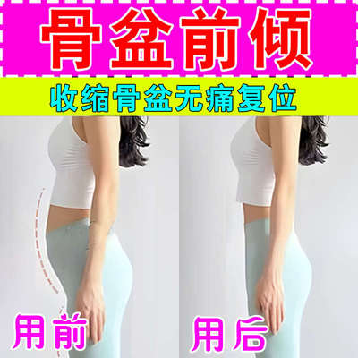 小腹前倾矫正器专用假修复胯神器骨盆胯改善塑形矫正收突出产后宽