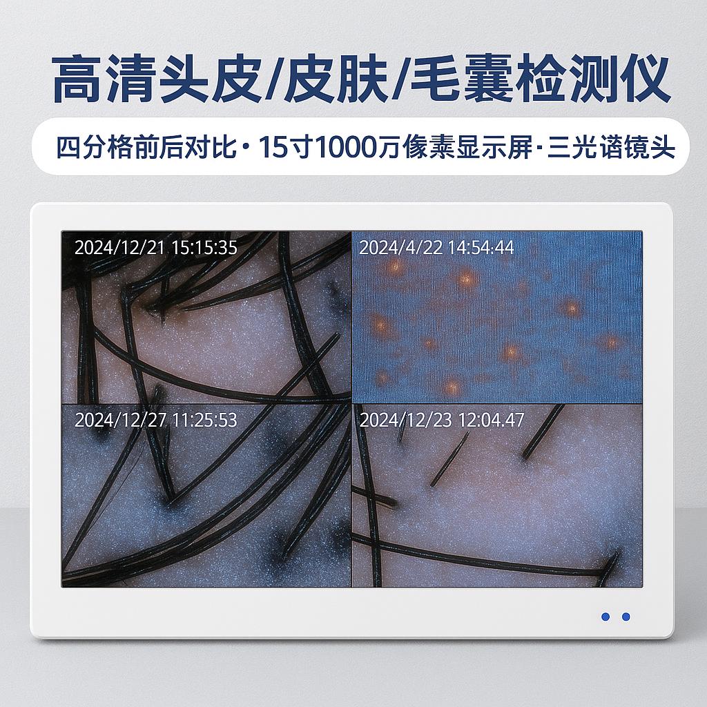 头皮毛囊检测仪高清头发皮肤脸部分析测试仪器理发店头疗店一体机