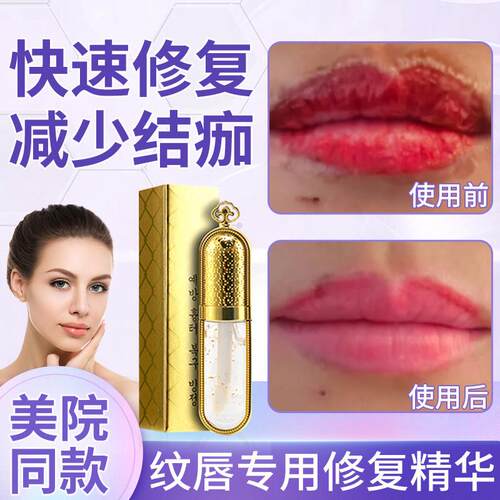 rg纹唇修复精华漂唇修复膏唇部去肿纹眉固色锁色修复剂纹绣不结痂
