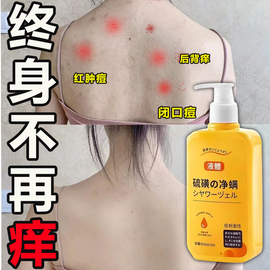 天然硫磺除螨沐浴露皮肤，瘙痒净螨止痒控油去除背上痘痘鸡皮肤去除
