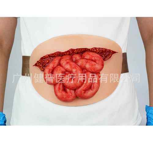 教学模型穿戴式小肠模型露出来小肠护理模型仿真人体肠模型