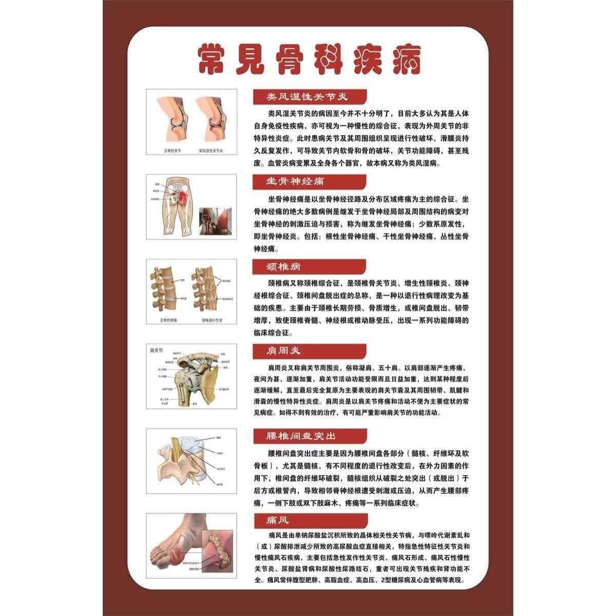 骨科常见疾病图谱 医学骨科挂图 人体骨骼结构展板 人体解剖海报