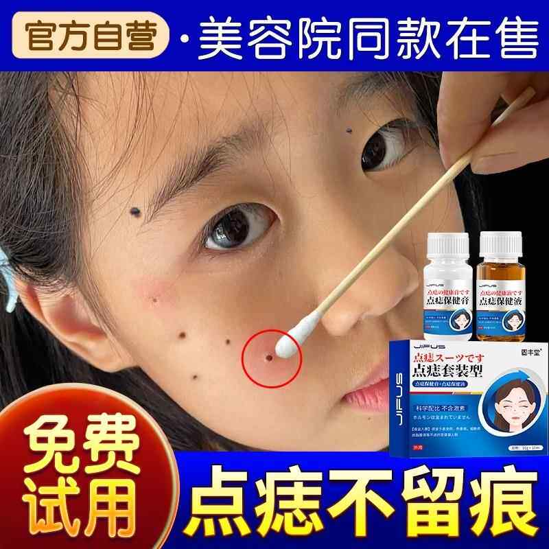 点痣膏无痕正品药膏水点痣笔脸部淡斑神器专用去非药水液痣旗舰店