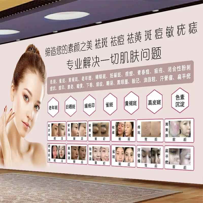 祛斑海报皮肤管理挂画祛痣广告祛痘宣传画斑痘敏图片美容院装饰画