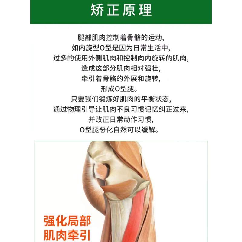 o型腿矫正器神器纠正xo型x型小腿内扣鞋垫膝盖外翻直腿成人罗圈腿