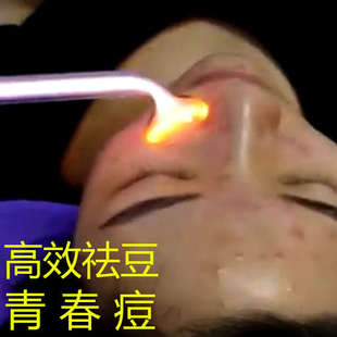 祛痘仪器高周波美容仪臭氧祛痘神器脸部除螨电疗棒杀菌去痘电疗仪