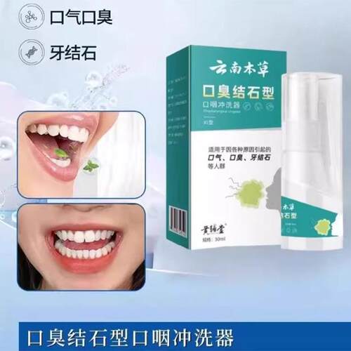 云南本草黄辅堂臭结石型冲洗器口腔喷雾口咽冲洗器口气现货清仓G2