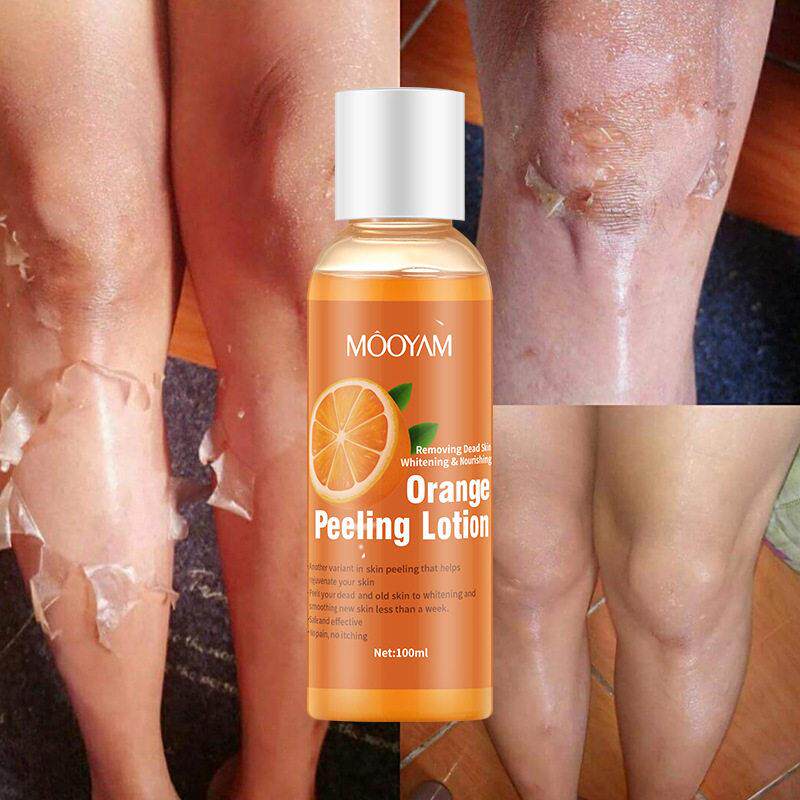 橙皮乳液脱皮油身体乳温和去角质啫喱凝露Orange Peeling Lotion