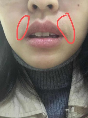 评测!不吹不黑蒂丝脱毛仪怎么样?买前担心,买后惊艳述说!