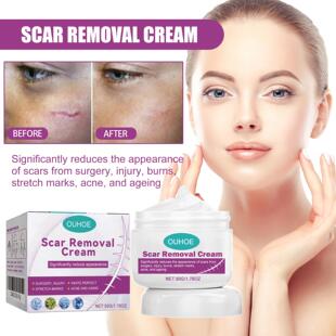 OUHOE Skin Care Cream - Gentle Nourishing and Moisturizing t
