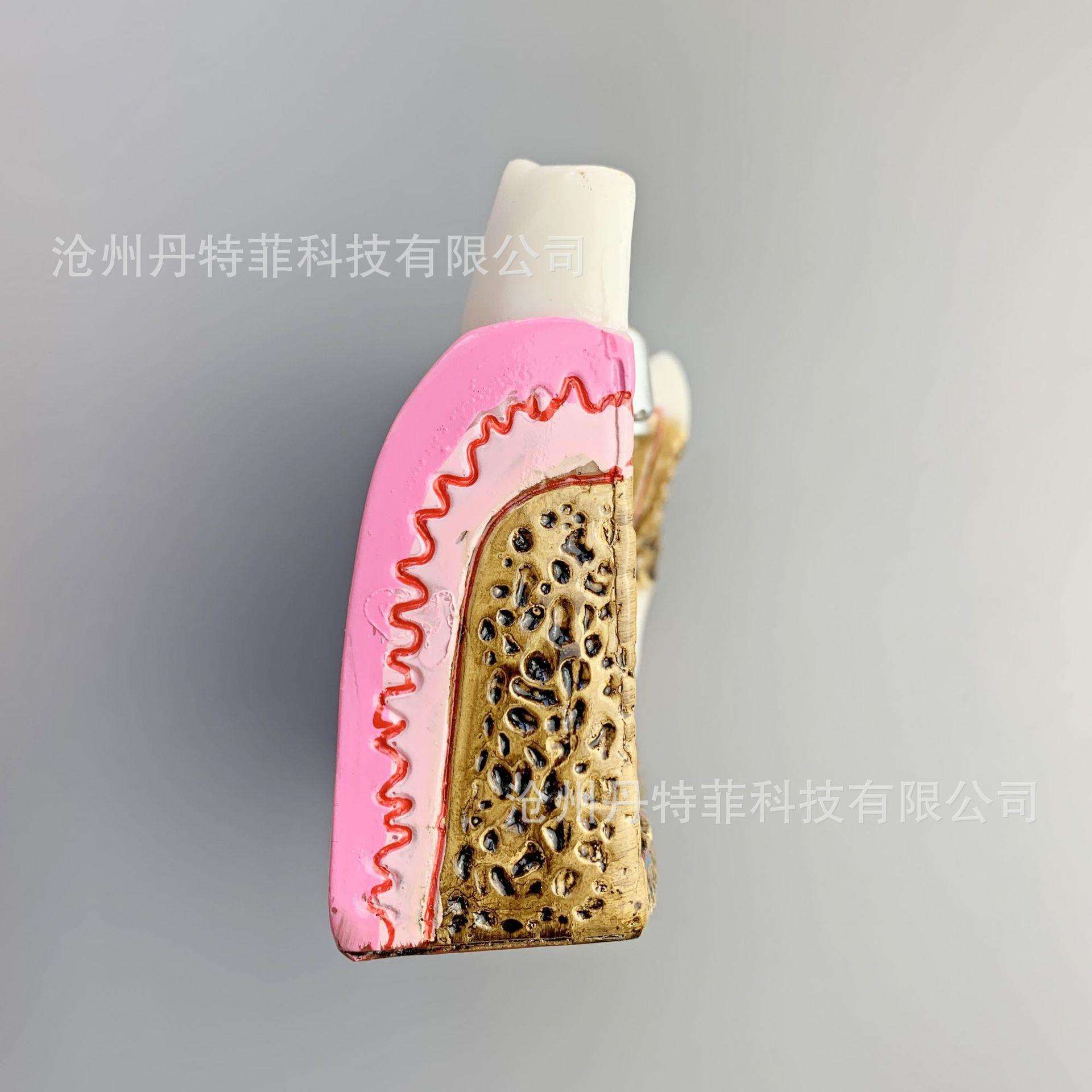 M4029病理牙齿模型 右下后牙组织分解模型