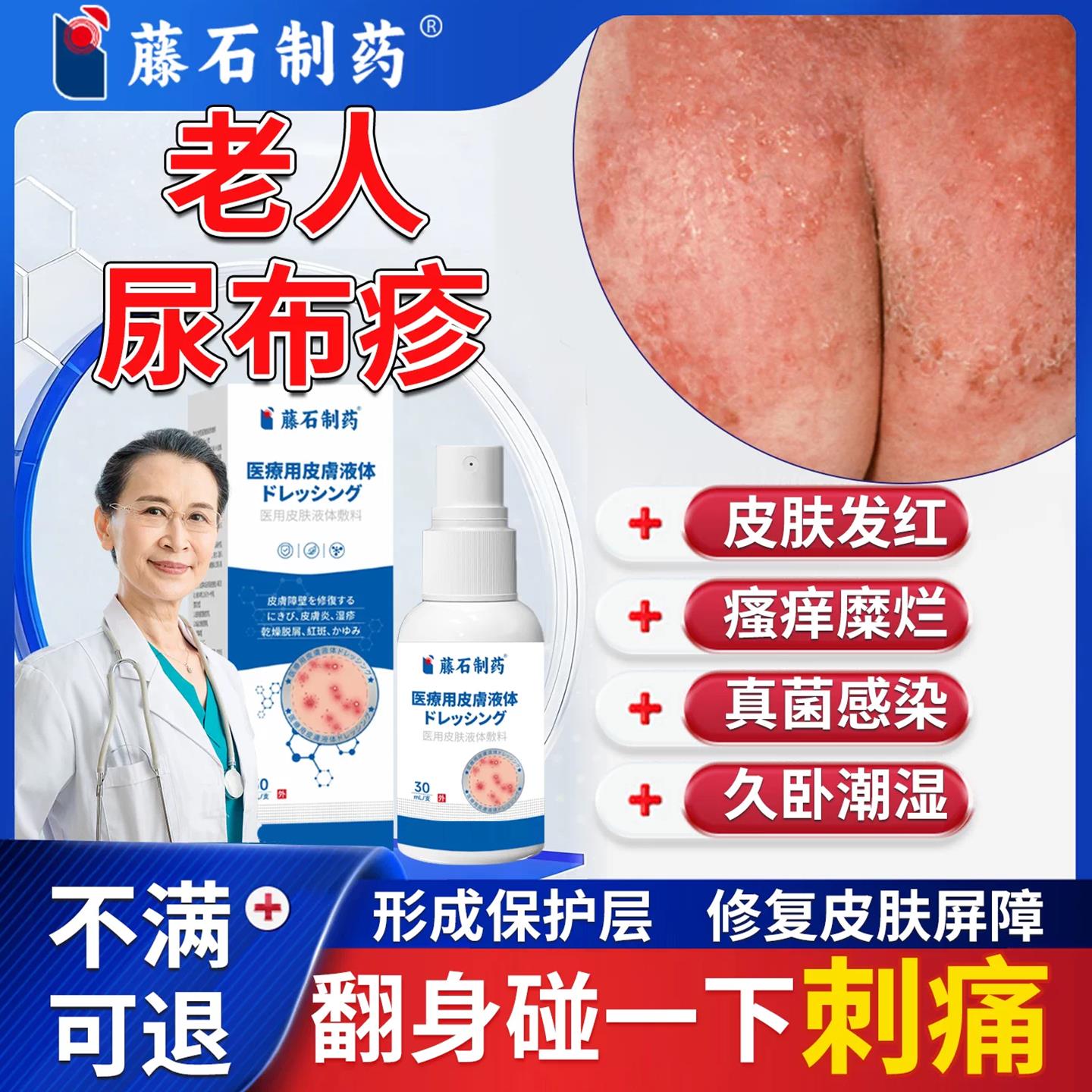 长期疹卧床瘫痪老人尿布皮炎红屁股药膏去破皮瘙痒除真菌感染QK医