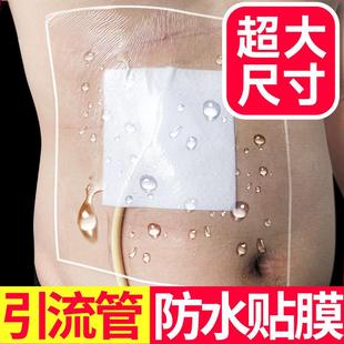 胃造瘘引流管防水膜胆管肾穿刺尿管洗澡膜