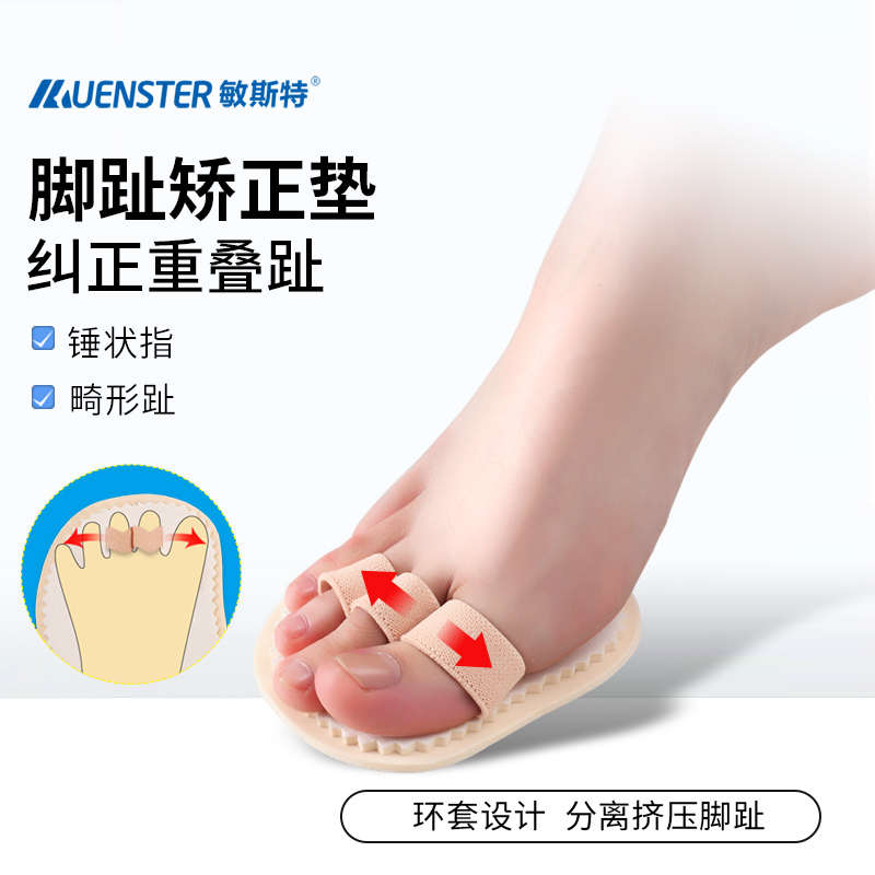 敏斯特拇指外翻重叠矫正垫锤状指脚骨分趾器脚趾矫正器可以穿鞋