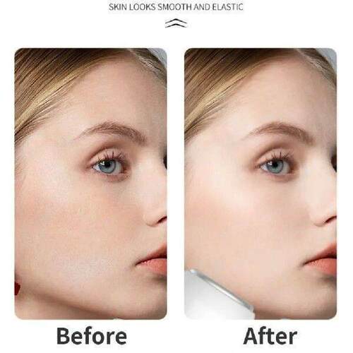 Double Side Facial Cooling Massager Eye Pouch Remover