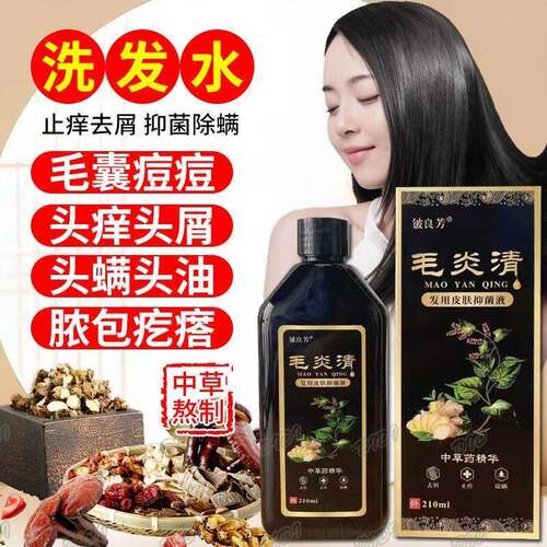 毛炎清去屑止痒洗发水毛囊痘痘炎专用去除大块头皮屑疙瘩抑菌止痒