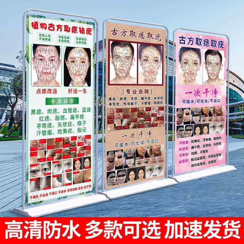 美容院祛痣点痣海报宣传图古方祛疣面部面相祛斑宣传广告展架图解