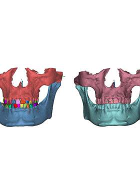 Mimics 3D Slicer口腔泌尿骨科医学三维重建CT图像处理分割帮代做