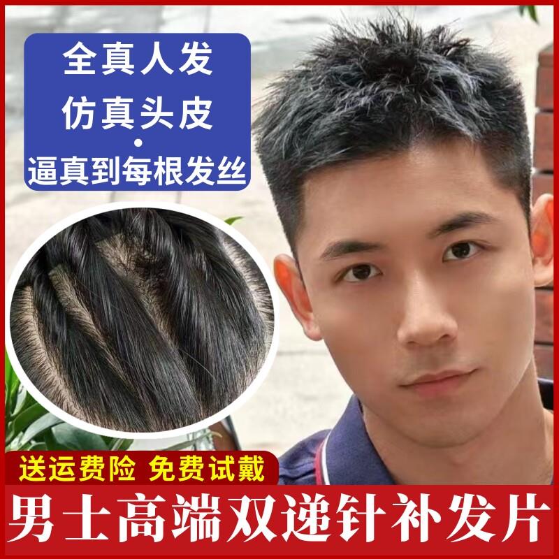 男士真发双递针头顶补发片彷真头皮高端假发男前额无痕隐形假发片