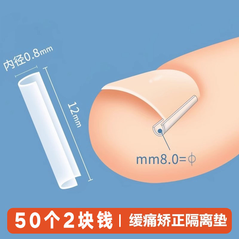 矫正器填充指甲隔离纠正美甲工具