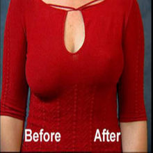 Coques pour soutien-gorge YYXD - Ref 818575 Image 49