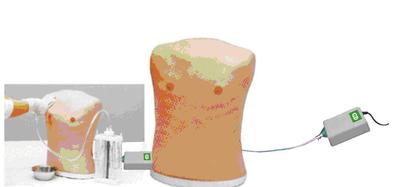 DF-QC型 气胸处理电动模型