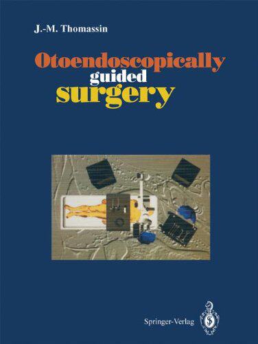 【预订】Otoendoscopically Guided Surgery