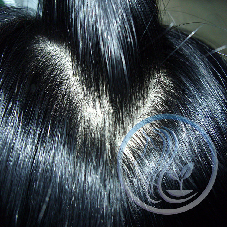 Extension cheveux - Ref 225236 Image 1