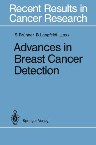 【预订】Advances in Breast Cancer Detection